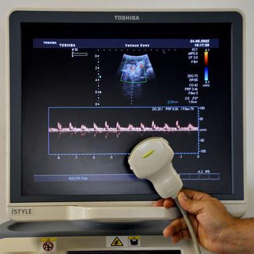 Used TOSHIBA XARIO XG SSA-680A ULTRASOUND SCANNER