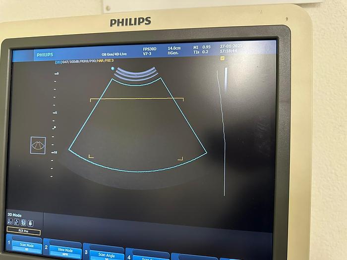 Used PHILIPS HD9 3D/4D ULTRASOUND with 4 PROBES