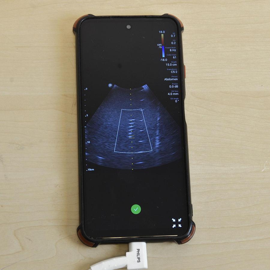 D'occasion LUMIFY C5-2 CONVEX PROBE