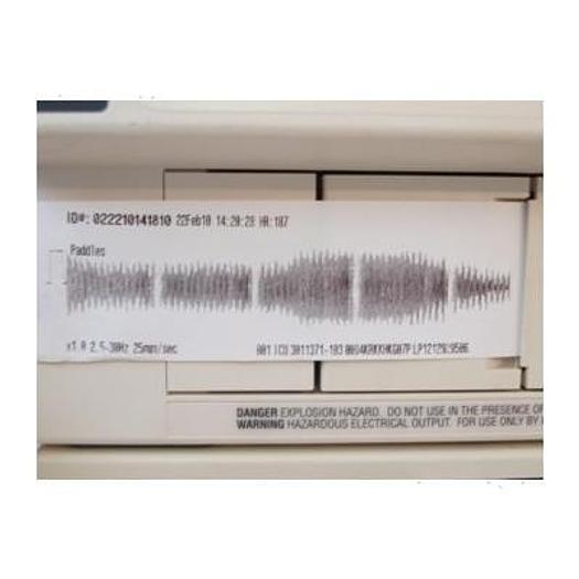 Used DEFIBRILATOR WITH ECG SCOPE LIFEPACK 12