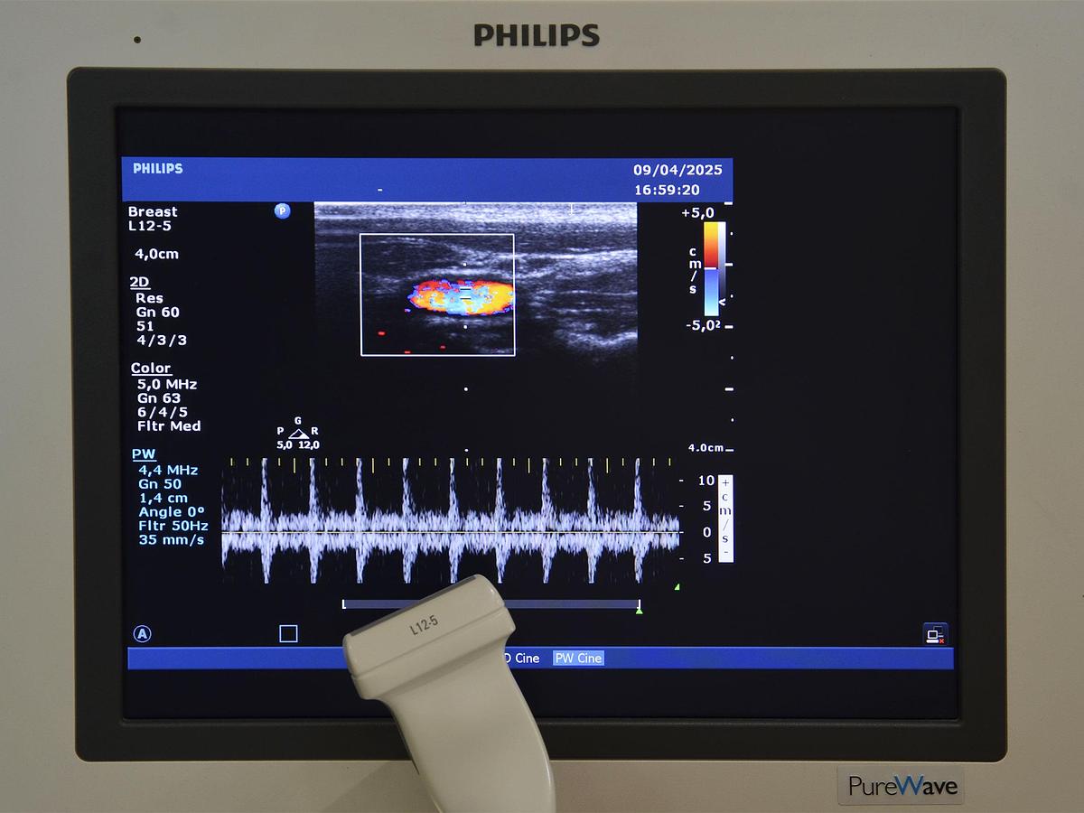 original-d-occasion-echographe-philips-hd-15-2-d-3-d-4-d-gyneco-et-radio.JPG
