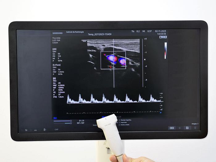 Used SAMSUNG HS 50 ULTRASOUND SCANNER