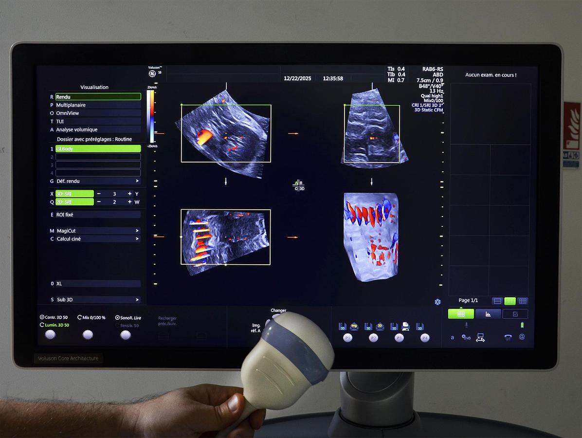 original-d-occasion-echographe-general-electric-voluson-s6.JPG
