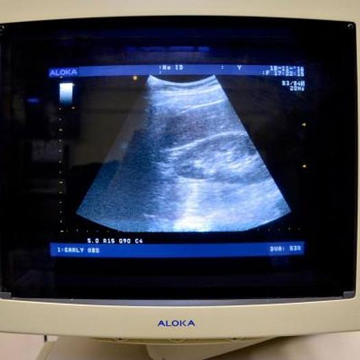 Used ALOKA SSD 4000 COLOR DOPPLER ULTRASOUND SCANNER WITH 2 PROBES