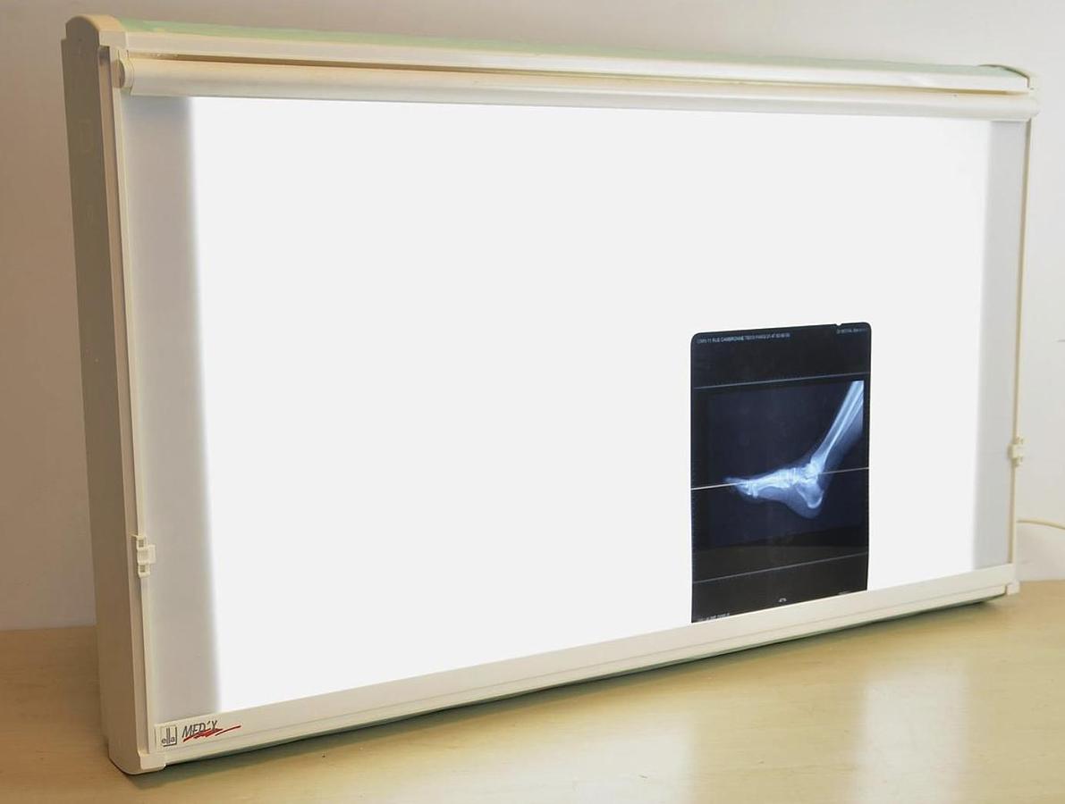 NEGATOSCOPE ELLA NM2  V 