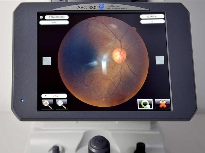 D'occasion NON MYDRIATIC RETINOGRAPH NIDEK 330