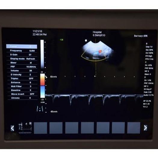 CAMSONIC 500 PORTABLE DIGITAL DOPPLER COLOR ULTRASOUND WITH 2 PROBES