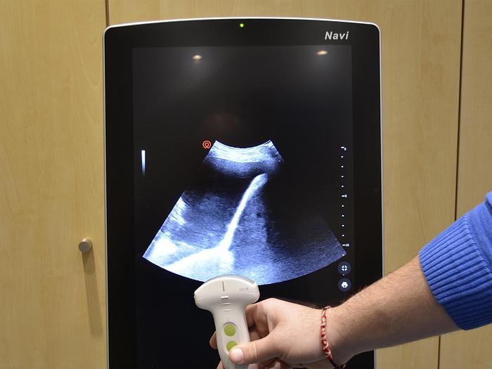 D'occasion ECHOGRAPHE WISONIC NAVI