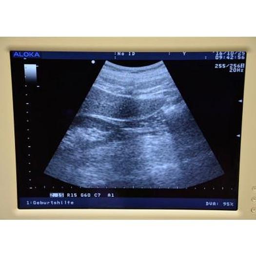 Used ALOKA/HITACHI PROSOUND 3500SX COLOR 3D/4D DOPPLER ULTRASOUND SCANNER