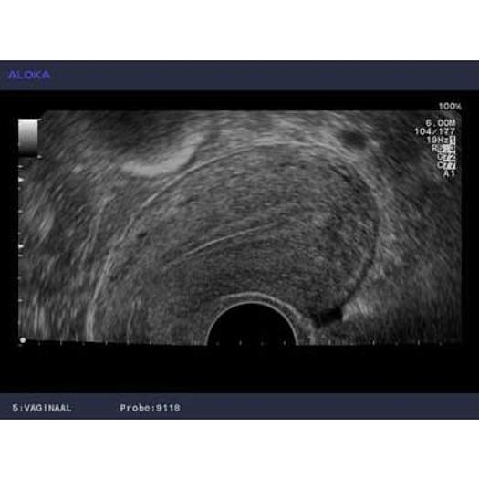 Used ALOKA SSD 4000 COLOR DOPPLER ULTRASOUND SCANNER
