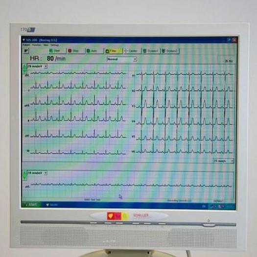 Used STRESS AND REST ECG SCHILLER CARDIOVIT CS 200
