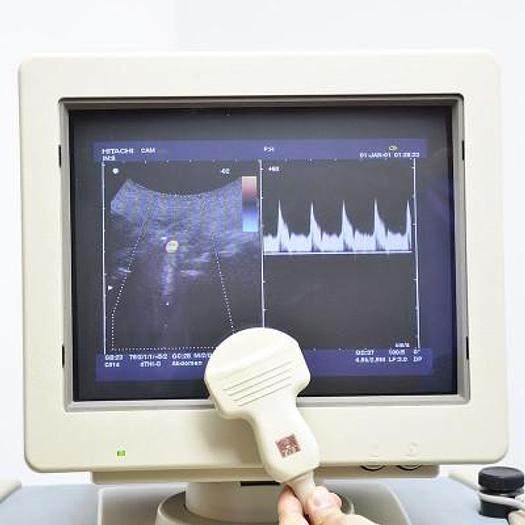 Used HITACHI ALPHA ULTRASOUND