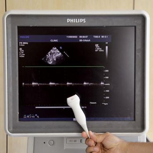 Used PHILIPS IU33 CARDIAC ECHOCARDIOGRAPH