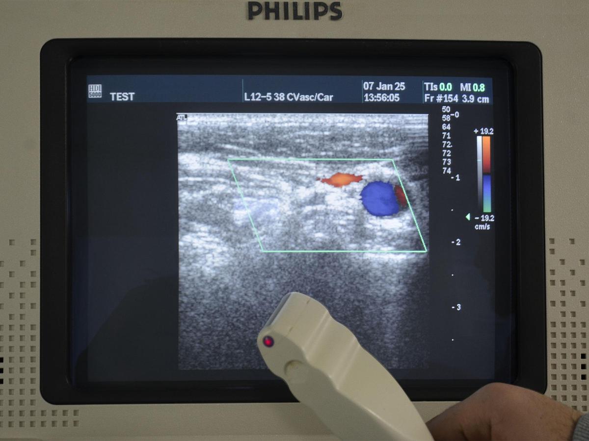 original-d-occasion-echographe-philips-hdi-5000.JPG