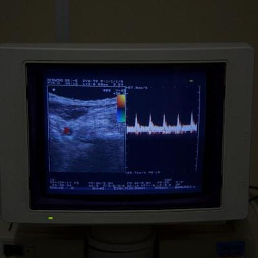 Used HITACHI ODYSSEE DOPPLER ULTRASOUND WITH 2 PROBES