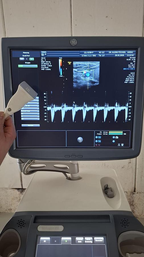 D'occasion ULTRASOUND GENERAL ELECTRIC GE VOLUSON E6