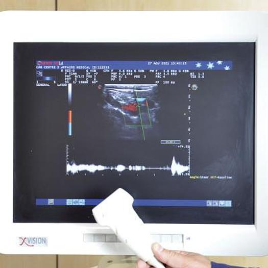 Used ESAOTE MyLab 60 ECHOGRAPH WITH PEDALS