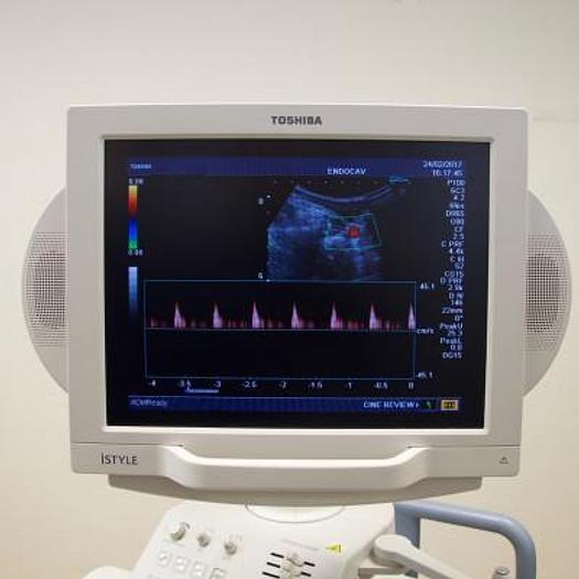 Used TOSHIBA NEMIO XG COLOR DOPPLER ULTRASOUND SCANNER WITH FLAT SCREEN AND 2 PROBES