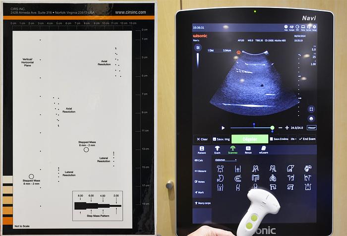D'occasion ECHOGRAPHE WISONIC NAVI