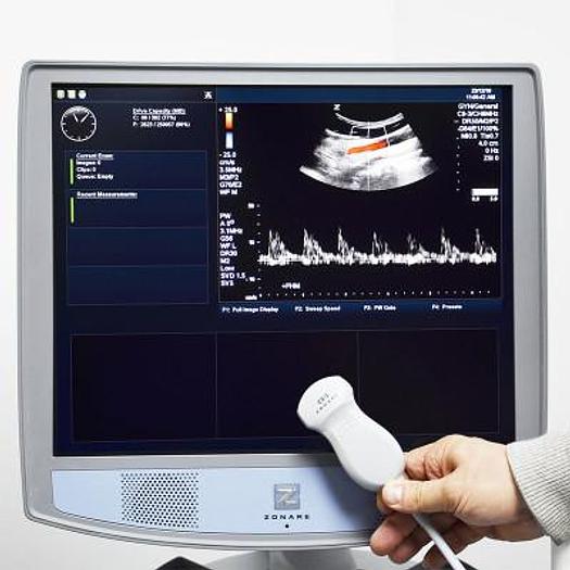 Used ZONARE Z.ONE SCAN SYSTEM VERSION 4.7.323F