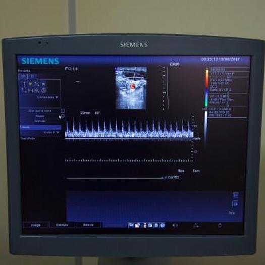 Used SIEMENS VF7-3 LINEAR FREQUENCY PROBE FROM 3 TO 7 MHZ FOR SIEMENS ANTARES