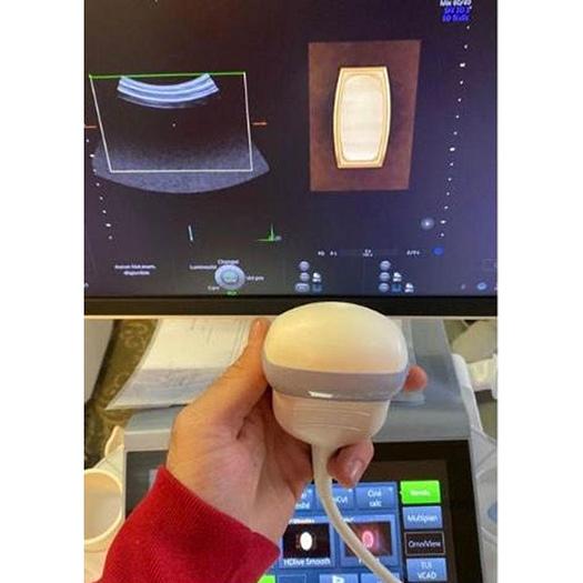 Used GE VOLUSON E8 RSA BT19 ULTRASOUND SCANNER