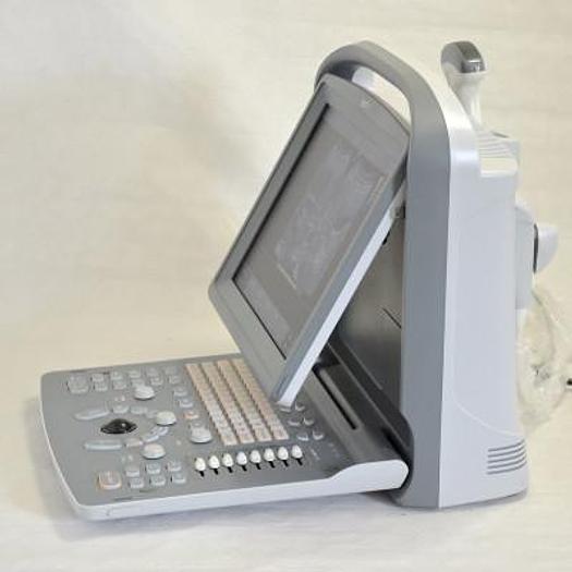 CHISON ECO1 PORTABLE ULTRASOUND WITH ABDOMINAL PROBE