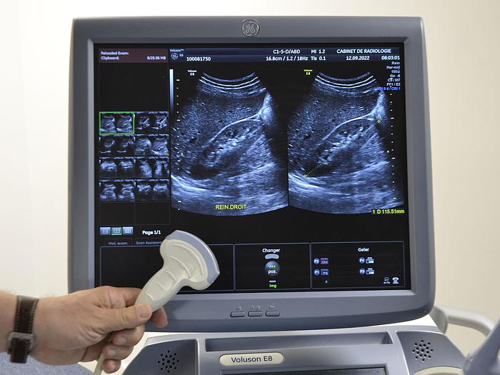 Used VOLUSON E8 GENERAL ELECTRIC ULTRASOUND