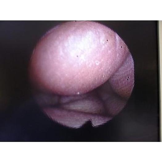 Used OLYMPUS HYF-XP FLEXIBLE HYSTEROFIBROSCOPE, VERY GOOD CONDITION