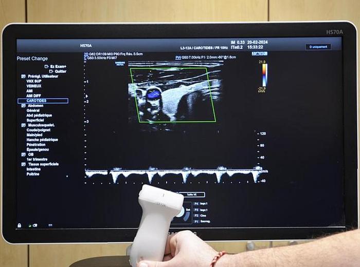 D'occasion ECHOGRAPHE CARDIAQUE  SAMSUNG HS 70 