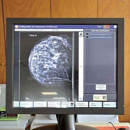 Used CARESTREAM KODAK CR ELITE DIGITIZING SYSTEM WITH PROCESSING CONSOLE