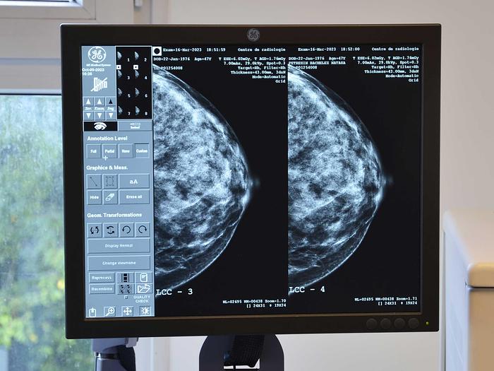 Used GE SENOCLAIRE 3D MAMMOGRAPH GENERAL ELECTRIC SENOCLAIRE mammograph (2011) with 3D TOMOSYNTHESE upgrade (2015) AND DETECTOR (changed in 2018).