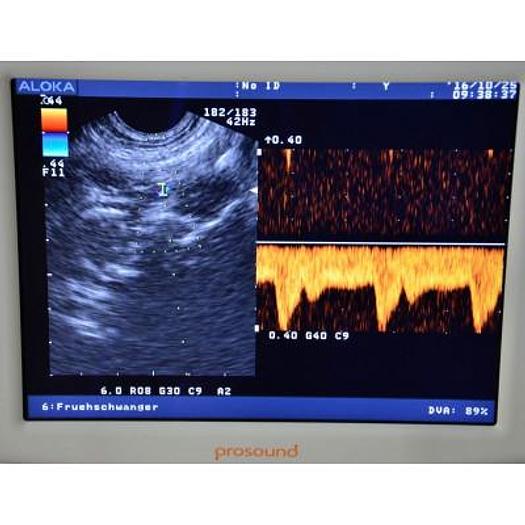 Used ALOKA/HITACHI PROSOUND 3500SX COLOR ULTRASOUND SCANNER