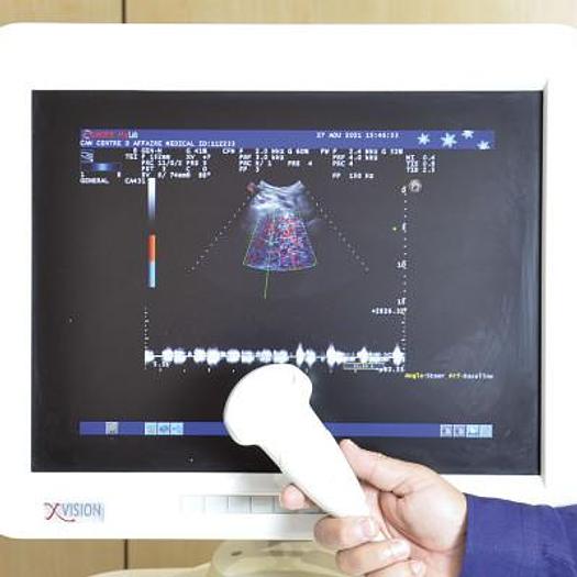 Used ESAOTE MyLab 60 ECHOGRAPH WITH PEDALS