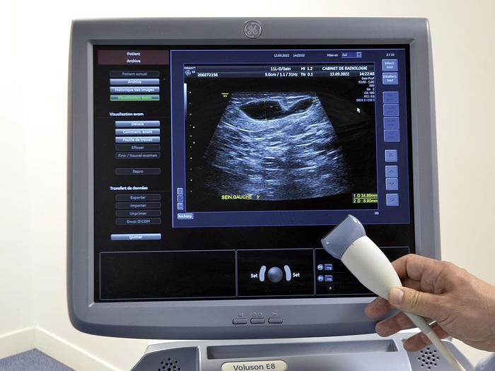 Used VOLUSON E8 GENERAL ELECTRIC ULTRASOUND