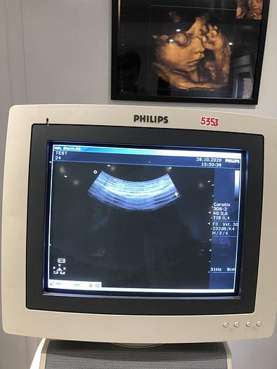 Gebraucht Philips HD11 Ultraschallgerät mit 3x Sonden, Sony Drucker UP-D895MD