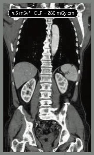 Used 2018 General Electric (GE) Optima CT660