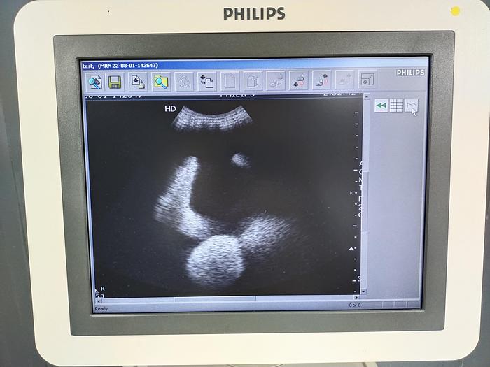 Gebraucht Philips HD7 diagnostik Ultraschallsystem mit DVD Brenner ohne Drucker SW 1.1