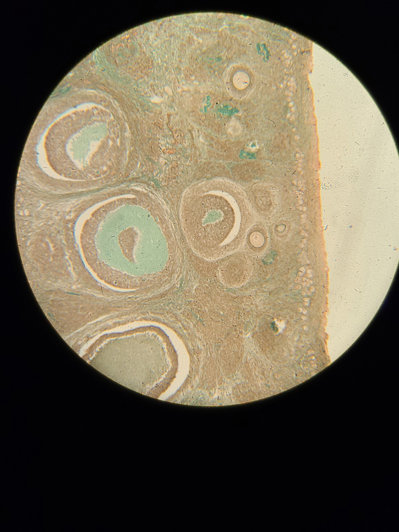 Used Olympus BX40F-3 Microscope w/ 5 Objectives & PlanApo100UV MDPlan150 Lab