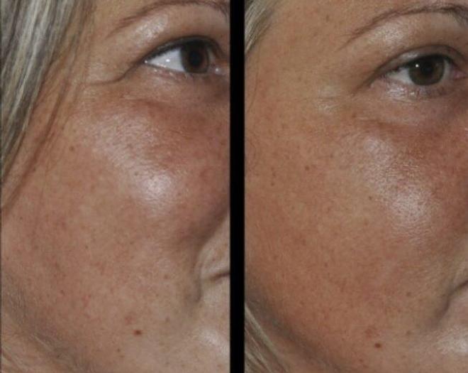 Coolifting – Beauty Gun