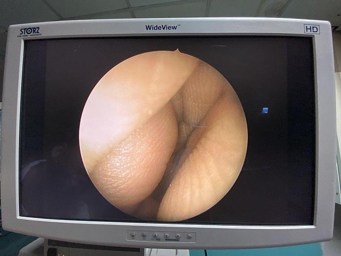 Used STORZ ENDOSKOP Hopkins 30 Grad 28731 BWA