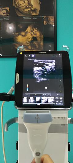 Gebraucht GE Venue 50 Ultraschalgerät mit 2 Sonden