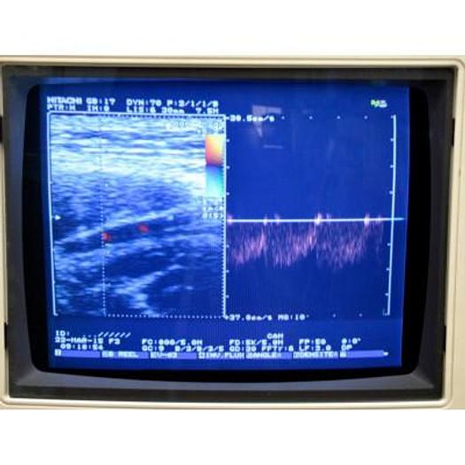D'occasion ECHOGRAPHE HITACHI KATANA 5 COULEUR DOPPLER AVEC 3 SONDES