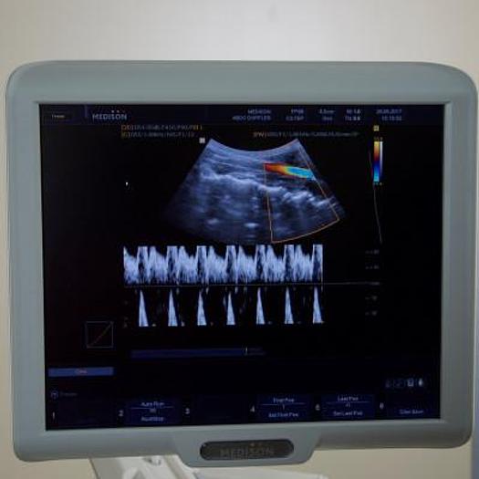 D'occasion ECHOGRAPHE  "RADIO+CARDIO"  MEDISON SONOACE X8 COULEUR DOPPLER 4 SONDES