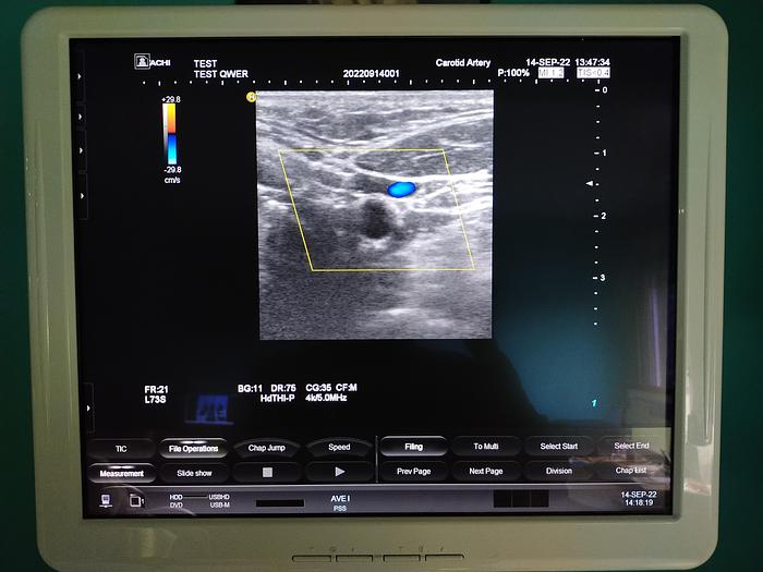 Gebraucht Hitachi Hi Vision Preirus Ultraschallgerät inkl. 3 Sonden, 