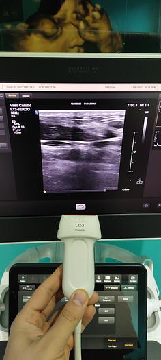 Gebraucht L12-3 ERGO Breitband-Linear-Schallkopf